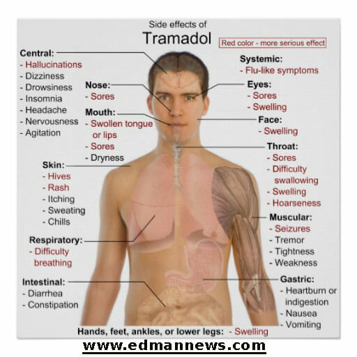 ادمان الترامادول