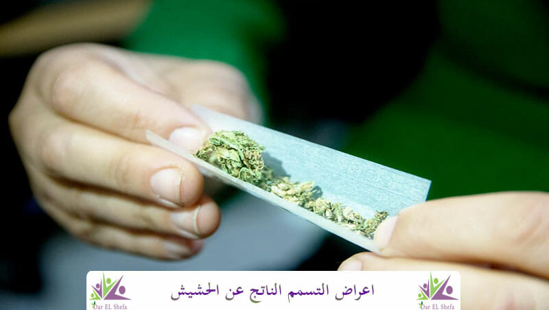 التسمم الناتج عن الحشيش